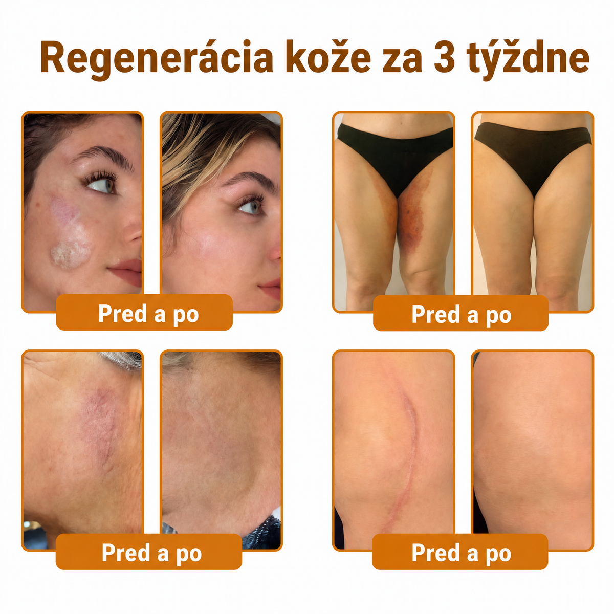 🐝💎 Healrize® Komplexný krém na tvár s včelím jedom – Nová generácia prírodnej starostlivosti o pleť pre hydratovanejšiu, hladšiu a žiarivejšiu pokožku 🌿✨