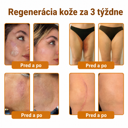 🐝💎 Healrize® Komplexný krém na tvár s včelím jedom – Nová generácia prírodnej starostlivosti o pleť pre hydratovanejšiu, hladšiu a žiarivejšiu pokožku 🌿✨