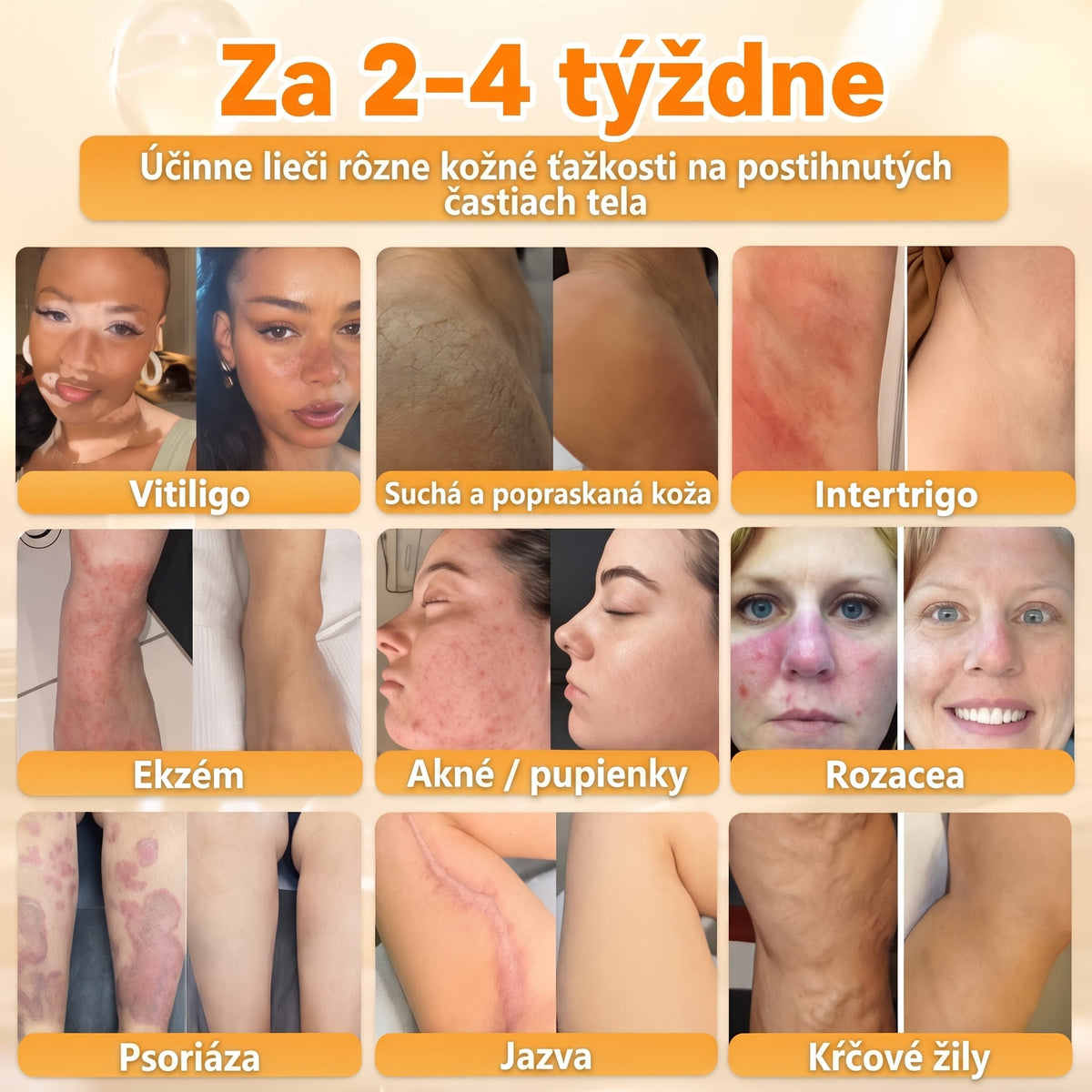 🐝💎 Healrize® Komplexný krém na tvár s včelím jedom – Nová generácia prírodnej starostlivosti o pleť pre hydratovanejšiu, hladšiu a žiarivejšiu pokožku 🌿✨