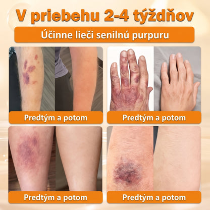 🐝💎 Healrize® Komplexný krém na tvár s včelím jedom – Nová generácia prírodnej starostlivosti o pleť pre hydratovanejšiu, hladšiu a žiarivejšiu pokožku 🌿✨