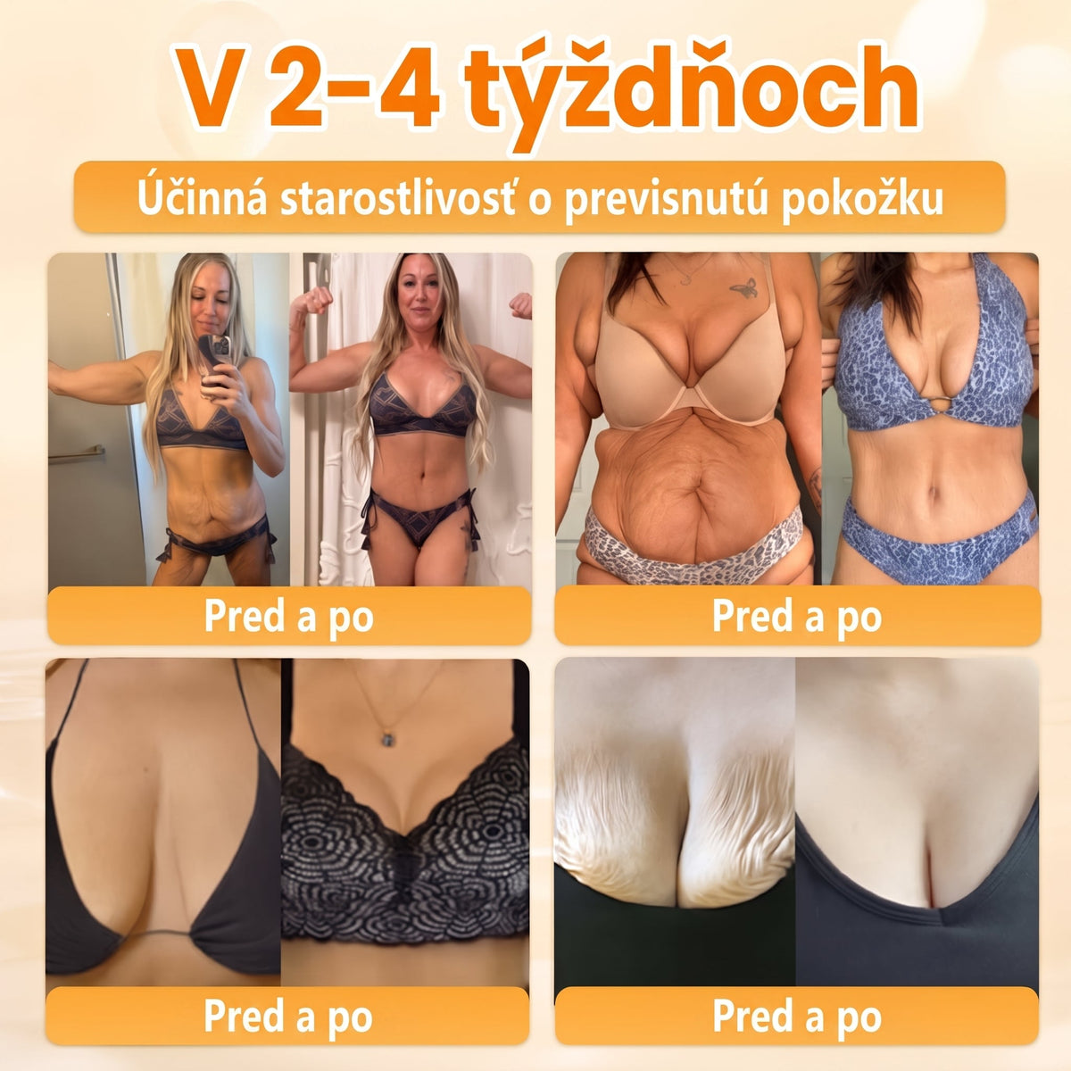 🐝💎 Healrize® Komplexný krém na tvár s včelím jedom – Nová generácia prírodnej starostlivosti o pleť pre hydratovanejšiu, hladšiu a žiarivejšiu pokožku 🌿✨