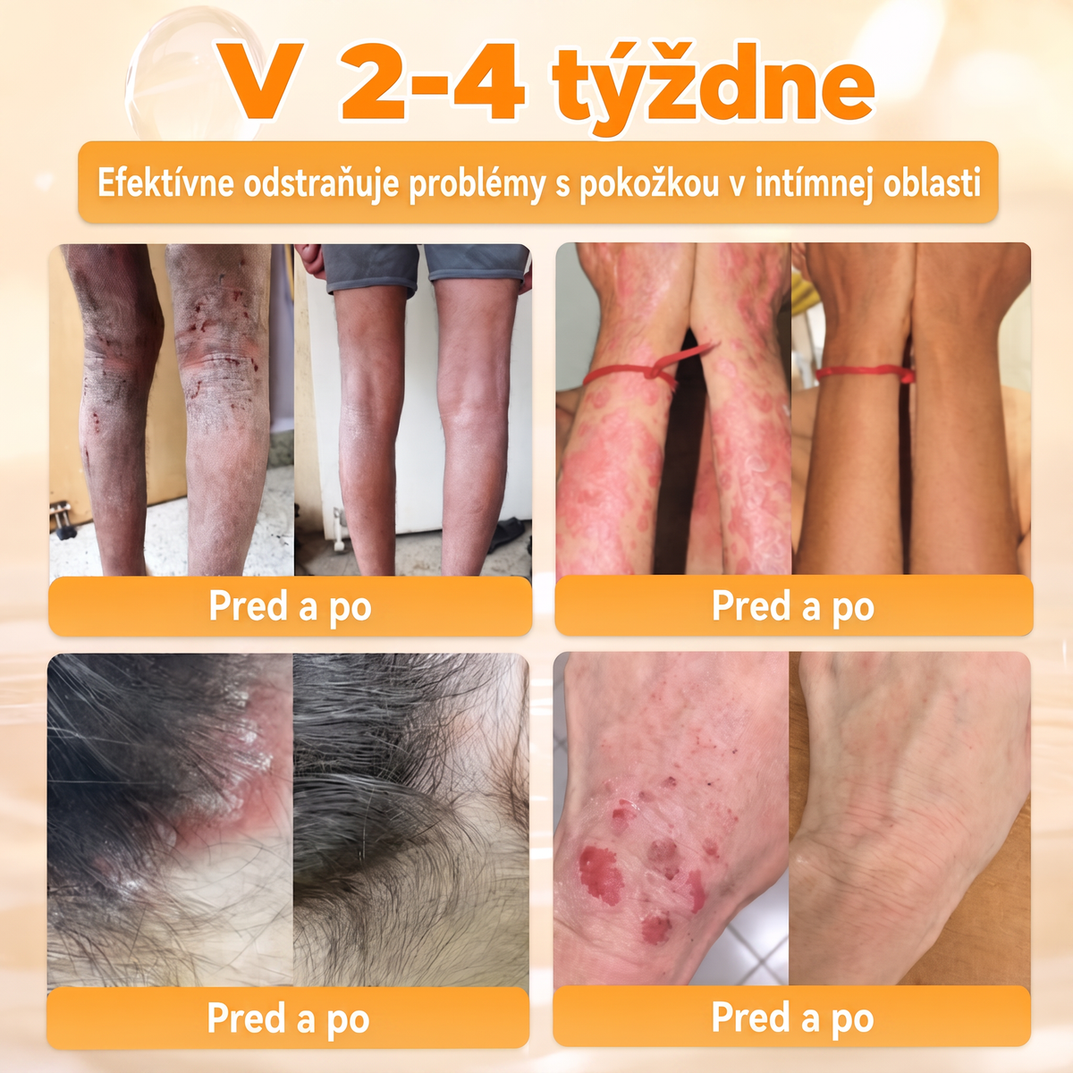 🐝💎 Healrize® Komplexný krém na tvár s včelím jedom – Nová generácia prírodnej starostlivosti o pleť pre hydratovanejšiu, hladšiu a žiarivejšiu pokožku 🌿✨