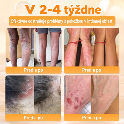 🐝💎 Healrize® Komplexný krém na tvár s včelím jedom – Nová generácia prírodnej starostlivosti o pleť pre hydratovanejšiu, hladšiu a žiarivejšiu pokožku 🌿✨