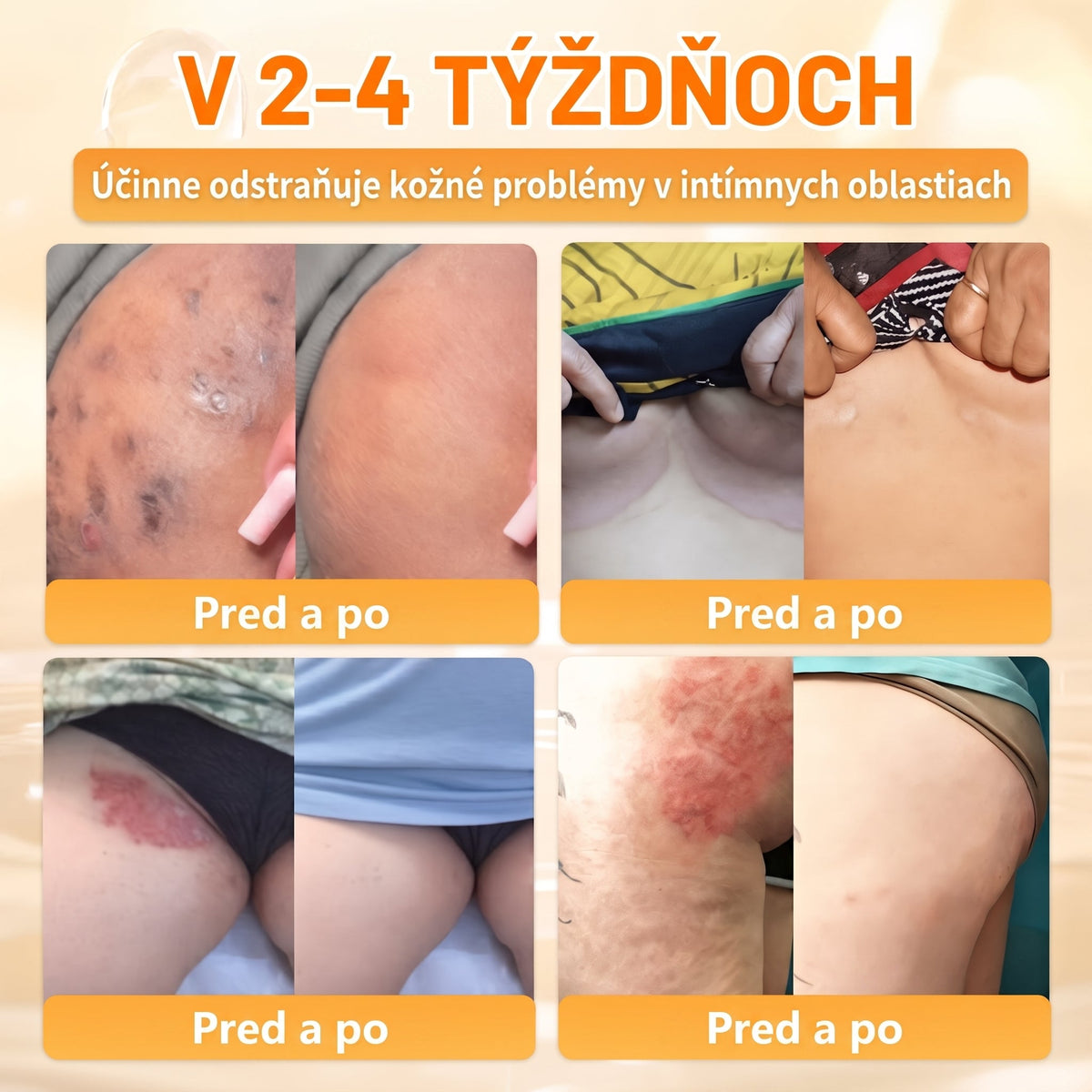 🐝💎 Healrize® Komplexný krém na tvár s včelím jedom – Nová generácia prírodnej starostlivosti o pleť pre hydratovanejšiu, hladšiu a žiarivejšiu pokožku 🌿✨