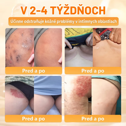 🐝💎 Healrize® Komplexný krém na tvár s včelím jedom – Nová generácia prírodnej starostlivosti o pleť pre hydratovanejšiu, hladšiu a žiarivejšiu pokožku 🌿✨